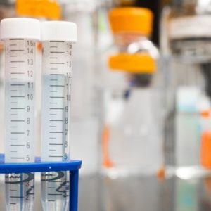 Thyroid Labs