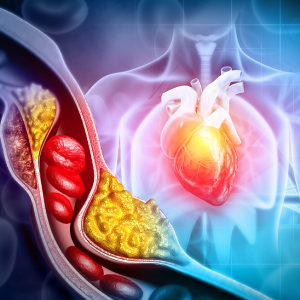 The Lipid Paradox